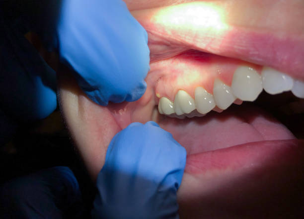 Best Weekend Emergency Dentist in Shadyside, OH